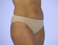 cpanty after caesarean underwear